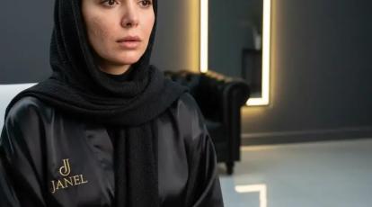 تاثیر قرص‌های راکوتان بر خدمات فشیال و لیزر چه زمانی برای زیبایی وقت بگیریم؟ [راهنمای ایمنی پوست]